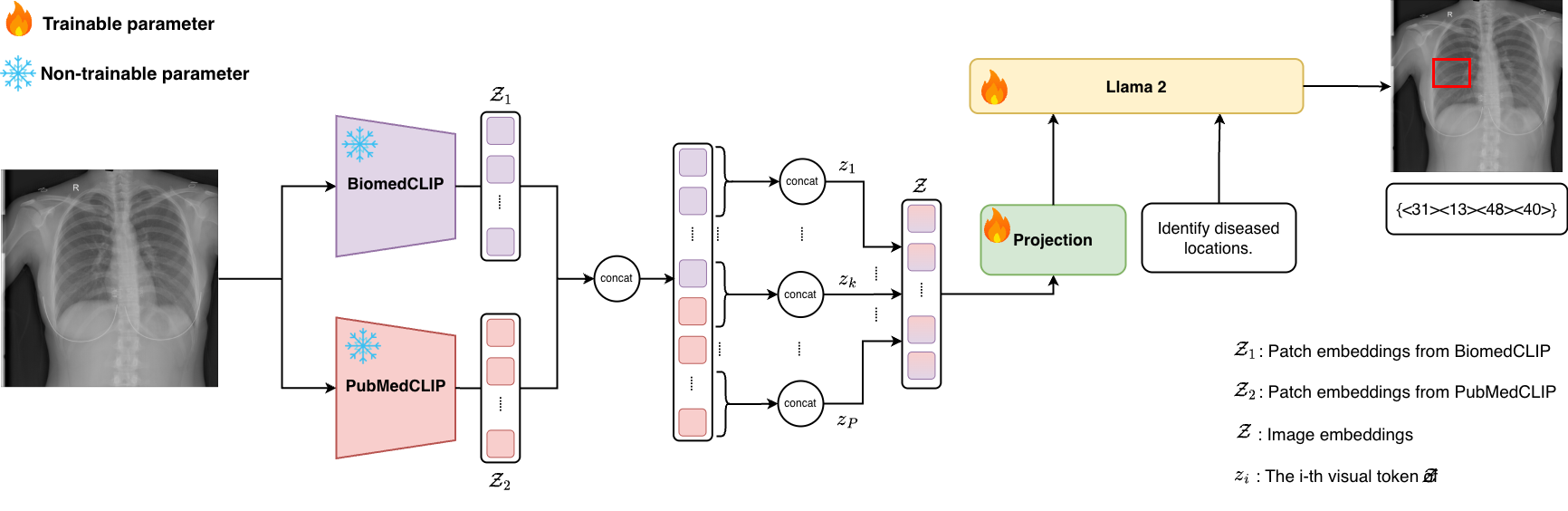 LiteGPT: Large Vision-Language Model for Joint Chest X-ray Localization and Classification Task